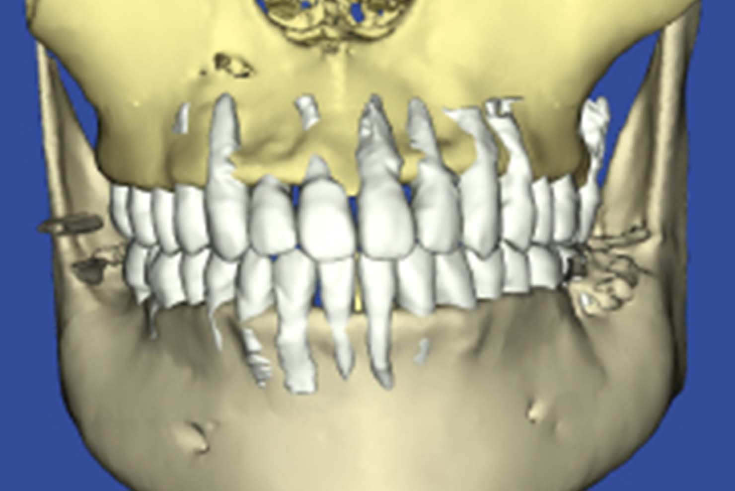 01.3D CBCT