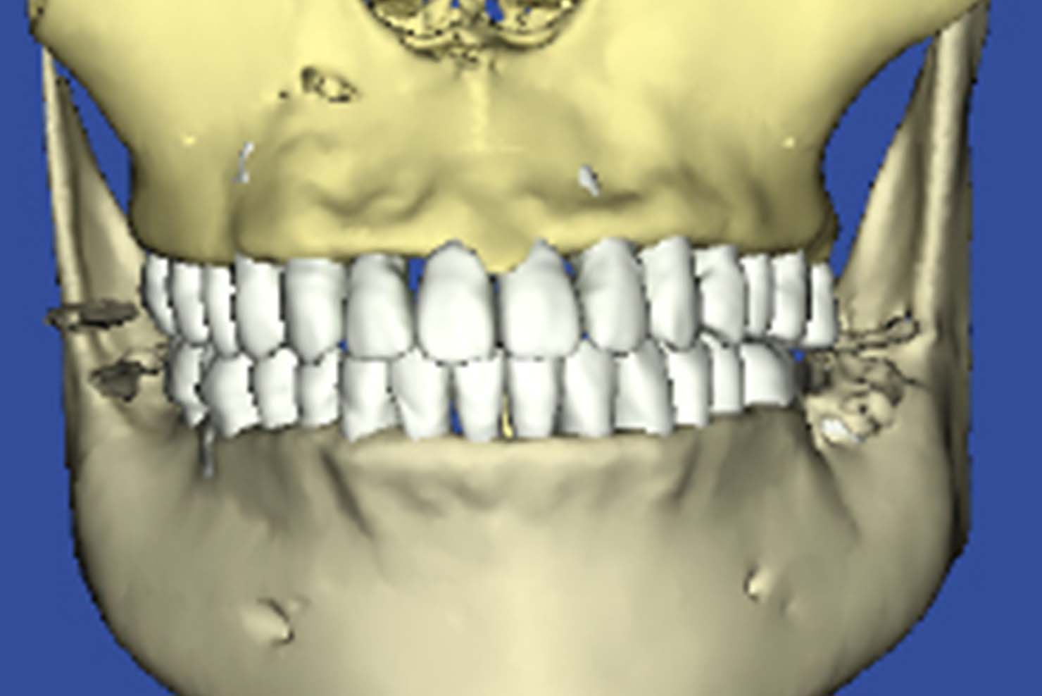 01.3D CBCT